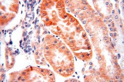 SNX5 Rabbit anti-Human, Mouse, Rat, Polyclonal, Proteintech 150 &mu;L;
