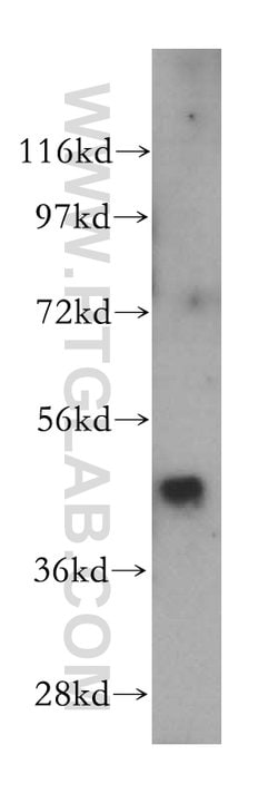 SNX5 Rabbit anti-Human, Mouse, Rat, Polyclonal, Proteintech 150 &mu;L;