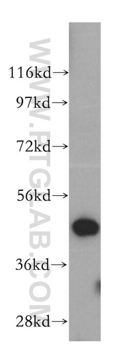 SNX5 Rabbit anti-Human, Mouse, Rat, Polyclonal, Proteintech 150 &mu;L;