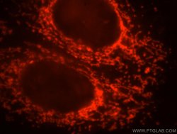ETFB Rabbit anti-Human, Mouse, Rat, Polyclonal, Proteintech:Antibodies:Primary