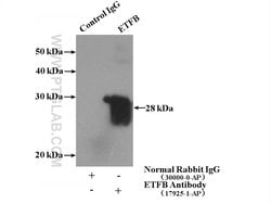 ETFB Rabbit anti-Human, Mouse, Rat, Polyclonal, Proteintech:Antibodies:Primary