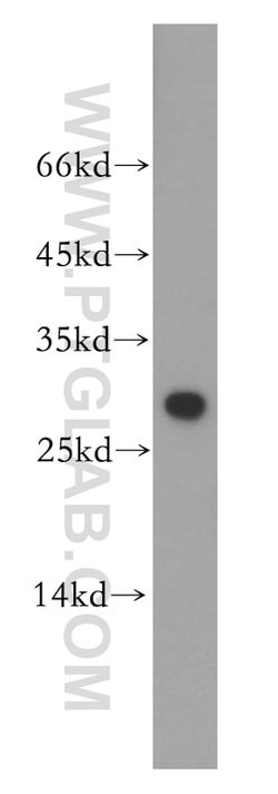 ETFB Rabbit anti-Human, Mouse, Rat, Polyclonal, Proteintech:Antibodies:Primary