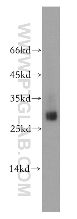 ETFB Rabbit anti-Human, Mouse, Rat, Polyclonal, Proteintech:Antibodies:Primary