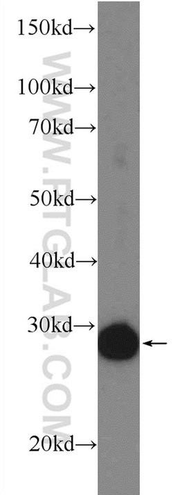 ETFB Rabbit anti-Human, Mouse, Rat, Polyclonal, Proteintech:Antibodies:Primary