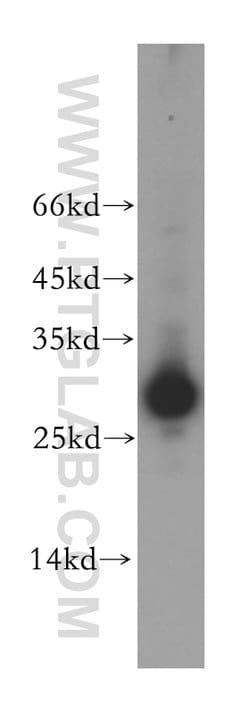 ETFB Rabbit anti-Human, Mouse, Rat, Polyclonal, Proteintech:Antibodies:Primary