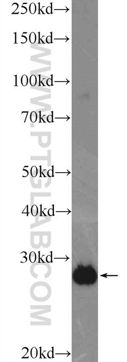 ETFB Rabbit anti-Human, Mouse, Rat, Polyclonal, Proteintech:Antibodies:Primary