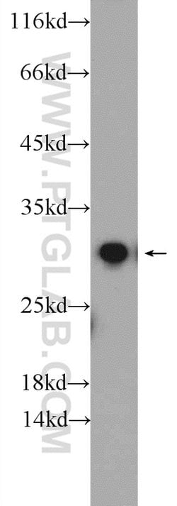 ETFB Rabbit anti-Human, Mouse, Rat, Polyclonal, Proteintech:Antibodies:Primary