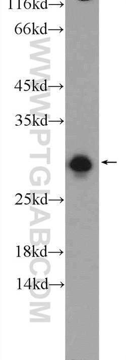 ETFB Rabbit anti-Human, Mouse, Rat, Polyclonal, Proteintech:Antibodies:Primary