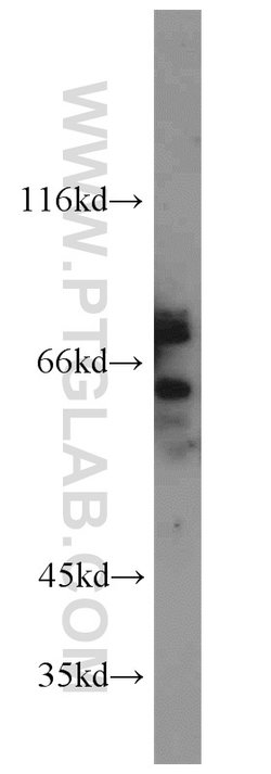 TUB Rabbit anti-Human, Mouse, Rat, Polyclonal, Proteintech 150 &mu;L; Unconjugated:Antibodies,