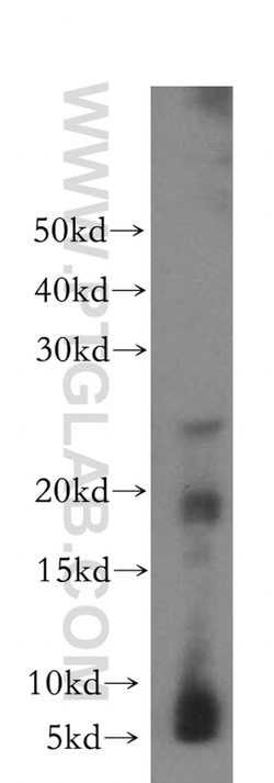 CRYGC Rabbit anti-Human, Mouse, Rat, Polyclonal, Proteintech 150 &mu;L | Buy Online | Proteintech Group Inc | Fisher Scientific