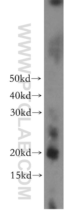 CRYGC Rabbit anti-Human, Mouse, Rat, Polyclonal, Proteintech 150 &mu;L | Buy Online | Proteintech Group Inc | Fisher Scientific