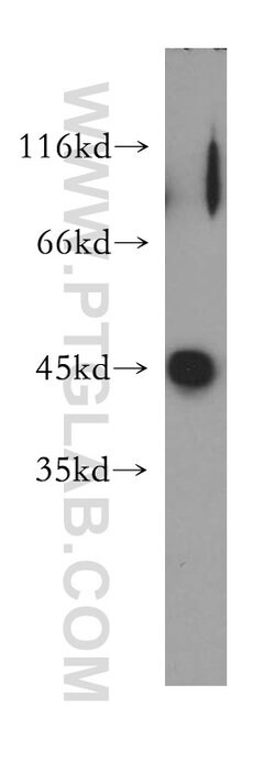 Galectin 9 Rabbit anti-Human, Polyclonal, Proteintech:Antibodies:Primary