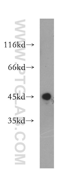 Galectin 9 Rabbit anti-Human, Polyclonal, Proteintech:Antibodies:Primary
