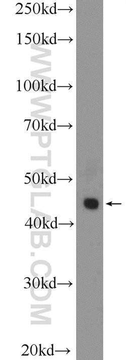 Galectin 9 Rabbit anti-Human, Polyclonal, Proteintech:Antibodies:Primary