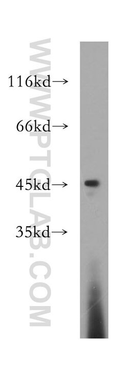 Galectin 9 Rabbit anti-Human, Polyclonal, Proteintech:Antibodies:Primary
