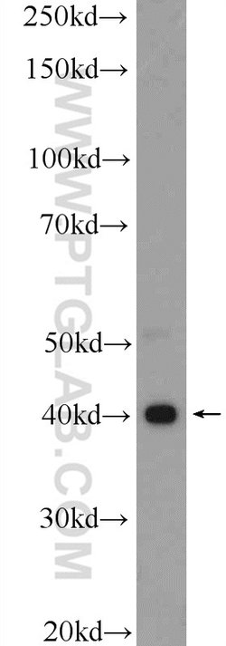 Galectin 9 Rabbit anti-Human, Polyclonal, Proteintech:Antibodies:Primary