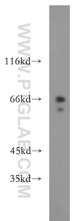 RPE65 Rabbit anti-Human, Mouse, Rat, Polyclonal, Proteintech:Antibodies:Primary
