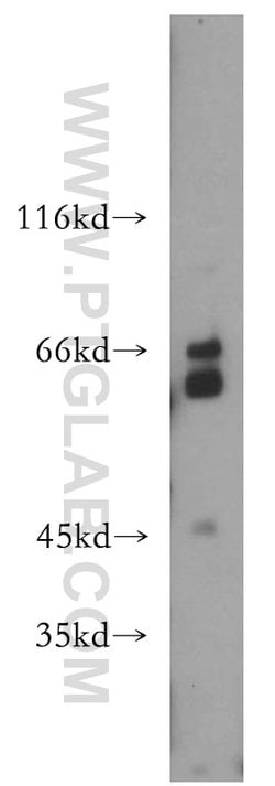 RPE65 Rabbit anti-Human, Mouse, Rat, Polyclonal, Proteintech:Antibodies:Primary