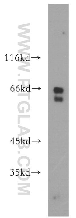 RPE65 Rabbit anti-Human, Mouse, Rat, Polyclonal, Proteintech:Antibodies:Primary