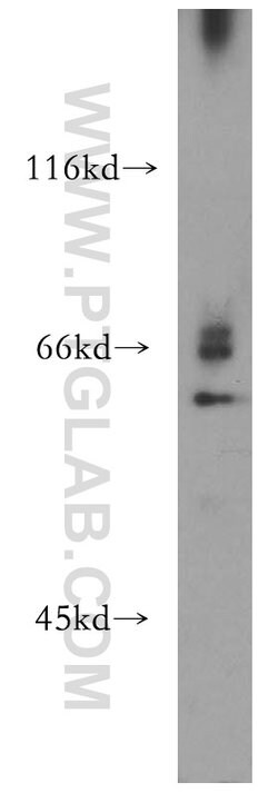 RPE65 Rabbit anti-Human, Mouse, Rat, Polyclonal, Proteintech:Antibodies:Primary
