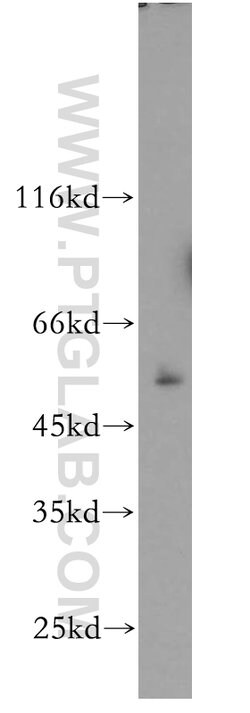 PRR5 Rabbit anti-Human, Mouse, Rat, Polyclonal, Proteintech 150 &mu;L; Unconjugated 