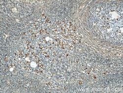 GPR177 Rabbit anti-Human, Mouse, Rat, Polyclonal, Proteintech:Antibodies:Primary