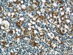 GPR177 Rabbit anti-Human, Mouse, Rat, Polyclonal, Proteintech:Antibodies:Primary