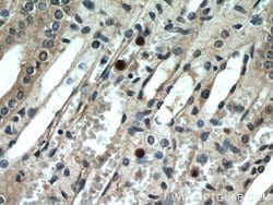 GPR177 Rabbit anti-Human, Mouse, Rat, Polyclonal, Proteintech:Antibodies:Primary