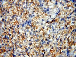 GPR177 Rabbit anti-Human, Mouse, Rat, Polyclonal, Proteintech:Antibodies:Primary
