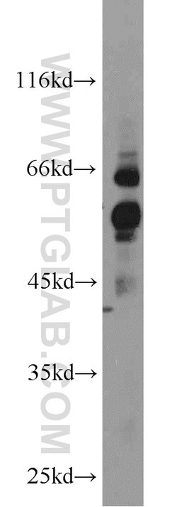GPR177 Rabbit anti-Human, Mouse, Rat, Polyclonal, Proteintech:Antibodies:Primary