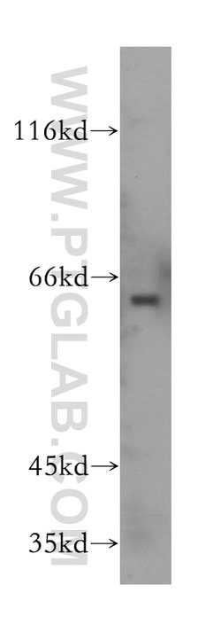 GPR177 Rabbit anti-Human, Mouse, Rat, Polyclonal, Proteintech:Antibodies:Primary