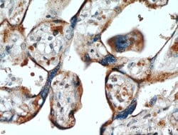 LOX Rabbit anti-Human, Mouse, Polyclonal, Proteintech:Antibodies:Primary