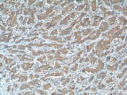 LOX Rabbit anti-Human, Mouse, Polyclonal, Proteintech:Antibodies:Primary