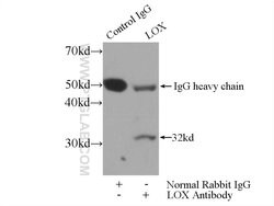 LOX Rabbit anti-Human, Mouse, Polyclonal, Proteintech:Antibodies:Primary