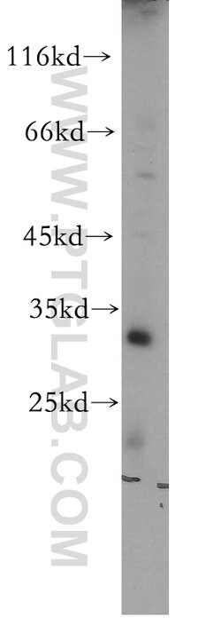 LOX Rabbit anti-Human, Mouse, Polyclonal, Proteintech:Antibodies:Primary