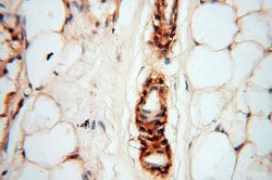 uPA Rabbit anti-Human, Mouse, Rat, Polyclonal, Proteintech:Anticorps:Anticorps