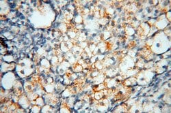 uPA Rabbit anti-Human, Mouse, Rat, Polyclonal, Proteintech:Anticorps:Anticorps
