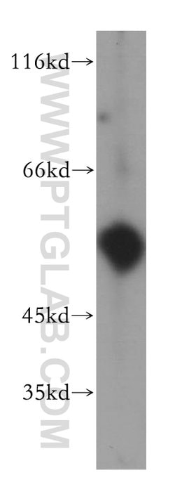 uPA Rabbit anti-Human, Mouse, Rat, Polyclonal, Proteintech:Anticorps:Anticorps