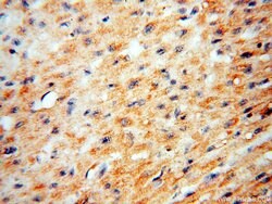 BPHL Rabbit anti-Human, Mouse, Rat, Polyclonal, Proteintech 150 &mu;L;