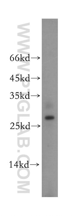 BPHL Rabbit anti-Human, Mouse, Rat, Polyclonal, Proteintech 150 &mu;L;