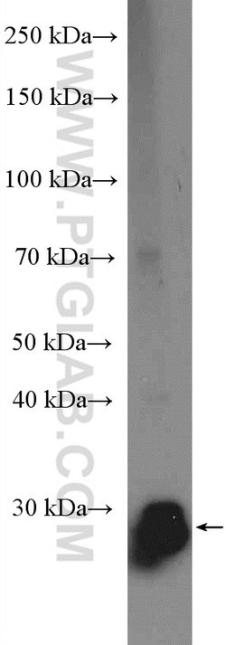 BPHL Rabbit anti-Human, Mouse, Rat, Polyclonal, Proteintech 150 &mu;L;