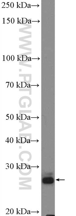 BPHL Rabbit anti-Human, Mouse, Rat, Polyclonal, Proteintech 150 &mu;L;