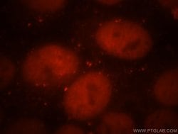 Cdc7 Kinase Rabbit anti-Human, Mouse, Rat, Polyclonal, Proteintech:Antibodies:Primary