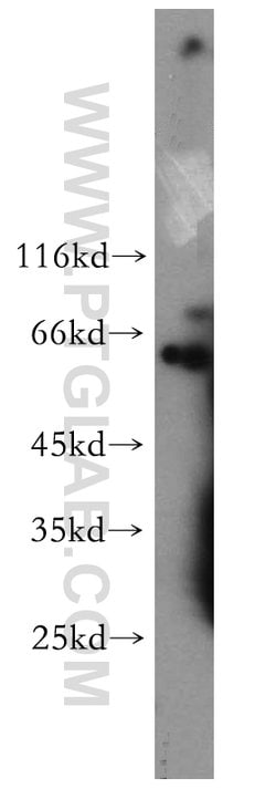 Cdc7 Kinase Rabbit anti-Human, Mouse, Rat, Polyclonal, Proteintech:Antibodies:Primary