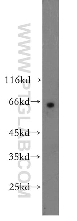 Cdc7 Kinase Rabbit anti-Human, Mouse, Rat, Polyclonal, Proteintech:Antibodies:Primary