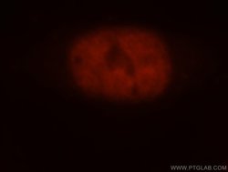 ADNP Rabbit anti-Human, Mouse, Rat, Polyclonal, Proteintech 150 &mu;L;