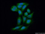 Thumbnail_PP11 Rabbit anti-Human, Mouse, Rat, Polyclonal, Proteintech 20 &mu;L; Unconjugated:Anticuerpos