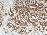 Thumbnail_PP11 Rabbit anti-Human, Mouse, Rat, Polyclonal, Proteintech 20 &mu;L; Unconjugated:Anticuerpos