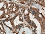 Thumbnail_PP11 Rabbit anti-Human, Mouse, Rat, Polyclonal, Proteintech 20 &mu;L; Unconjugated:Anticuerpos