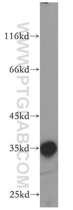 Thumbnail_PP11 Rabbit anti-Human, Mouse, Rat, Polyclonal, Proteintech 20 &mu;L; Unconjugated:Anticuerpos